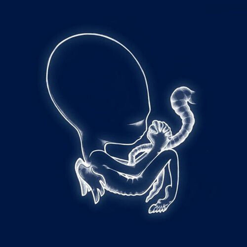 Sigur Ros - Agaeits Byrjun
